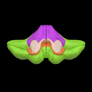 Cerebellum- 3 Lobes- Non-Animation