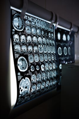 body-brain-scan-ct-cc0